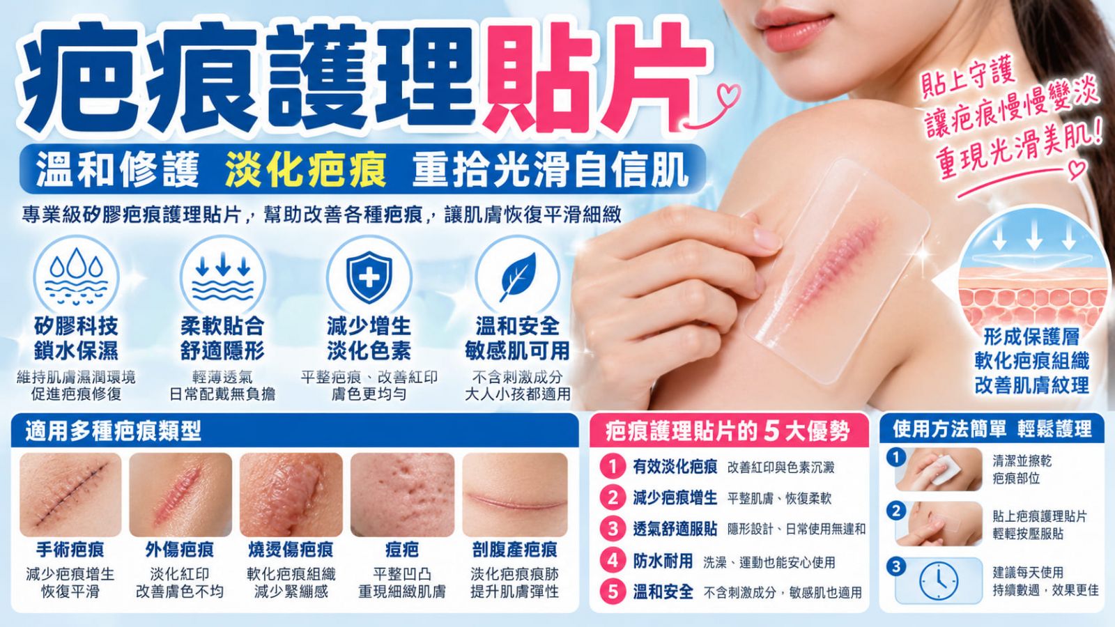 疤痕護理貼片怎麼選？矽膠疤痕貼片 vs 除疤凝膠差異、效果與費用完整比較